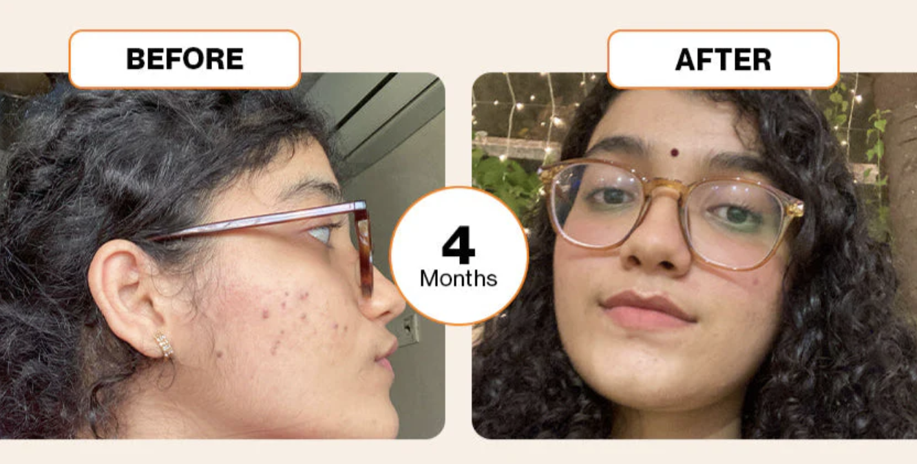 Before and After 4 Months Transformation